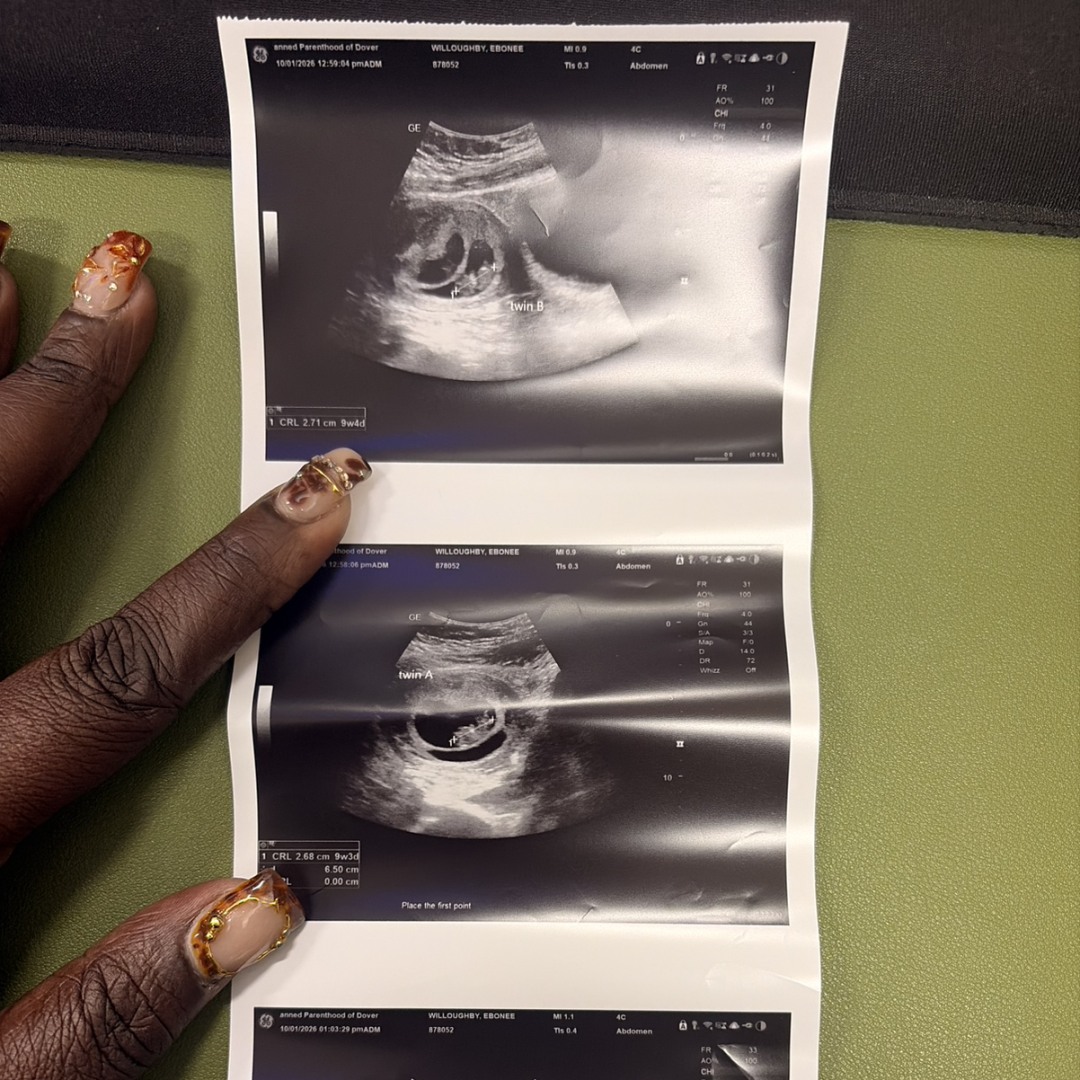 Photo shared by Ebonee for their Babylist baby registry.