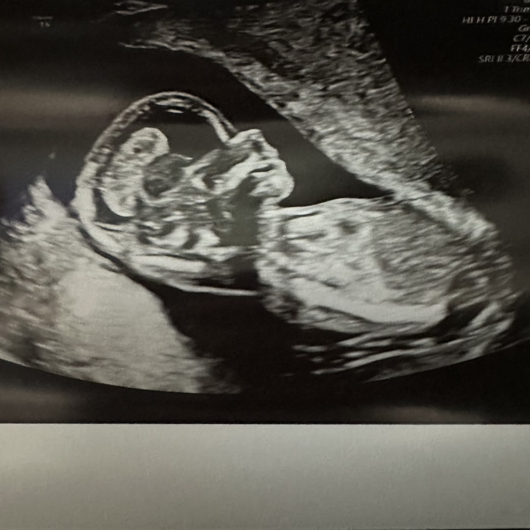 Photo shared by Carol Jean for their Babylist baby registry.