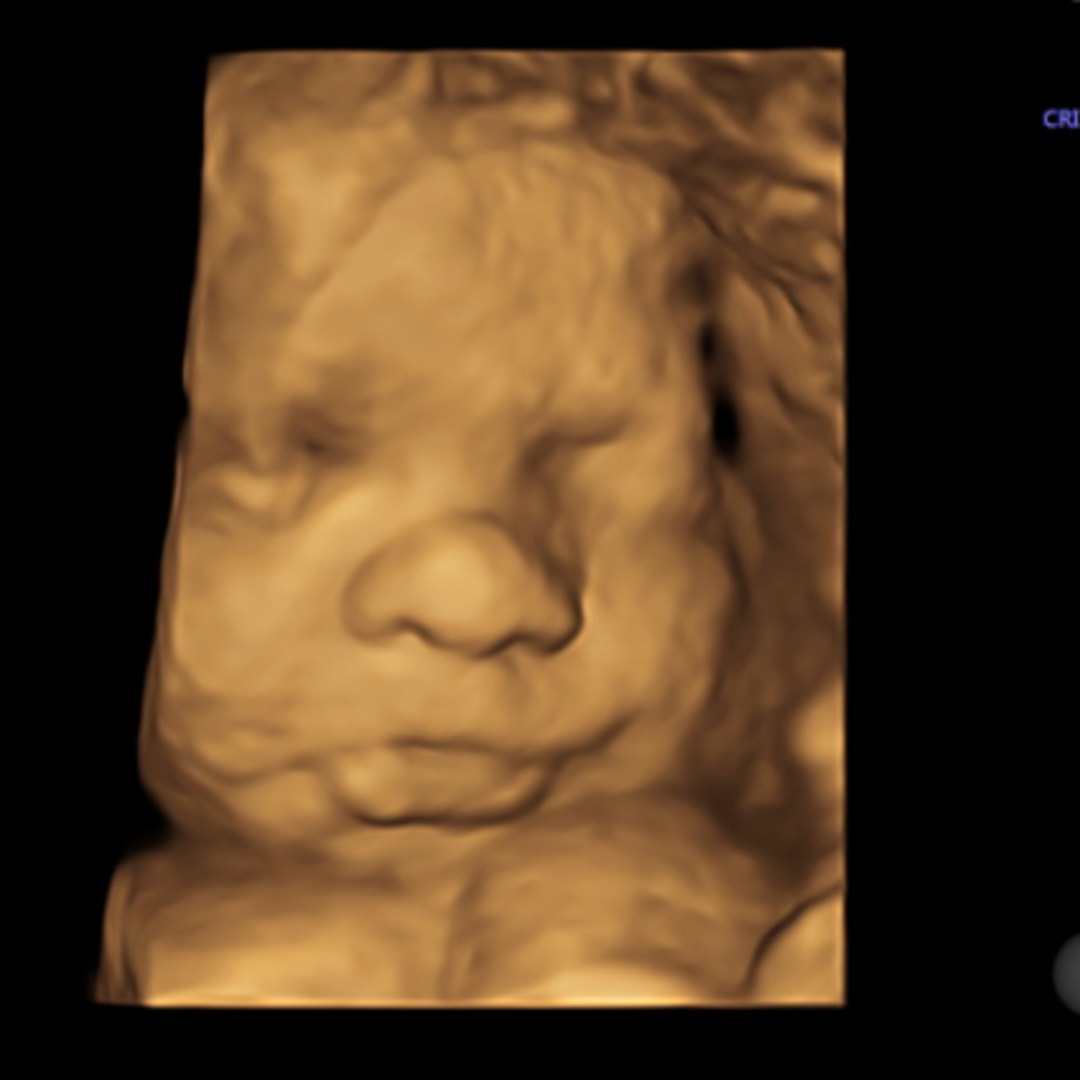 Photo shared by Samantha for their Babylist baby registry.