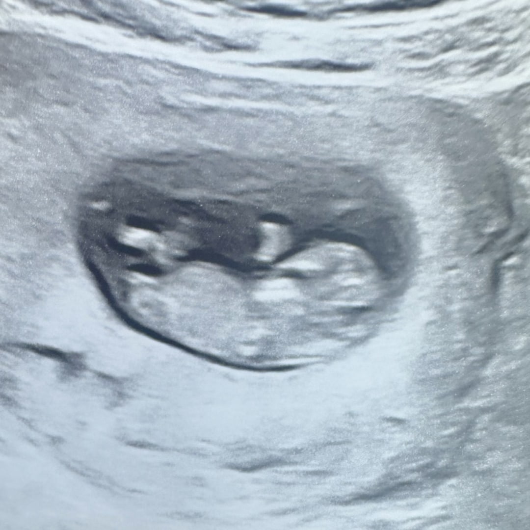 Photo shared by Chelsea for their Babylist baby registry.