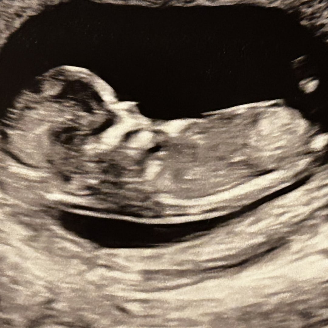 Photo shared by Monique for their Babylist baby registry.