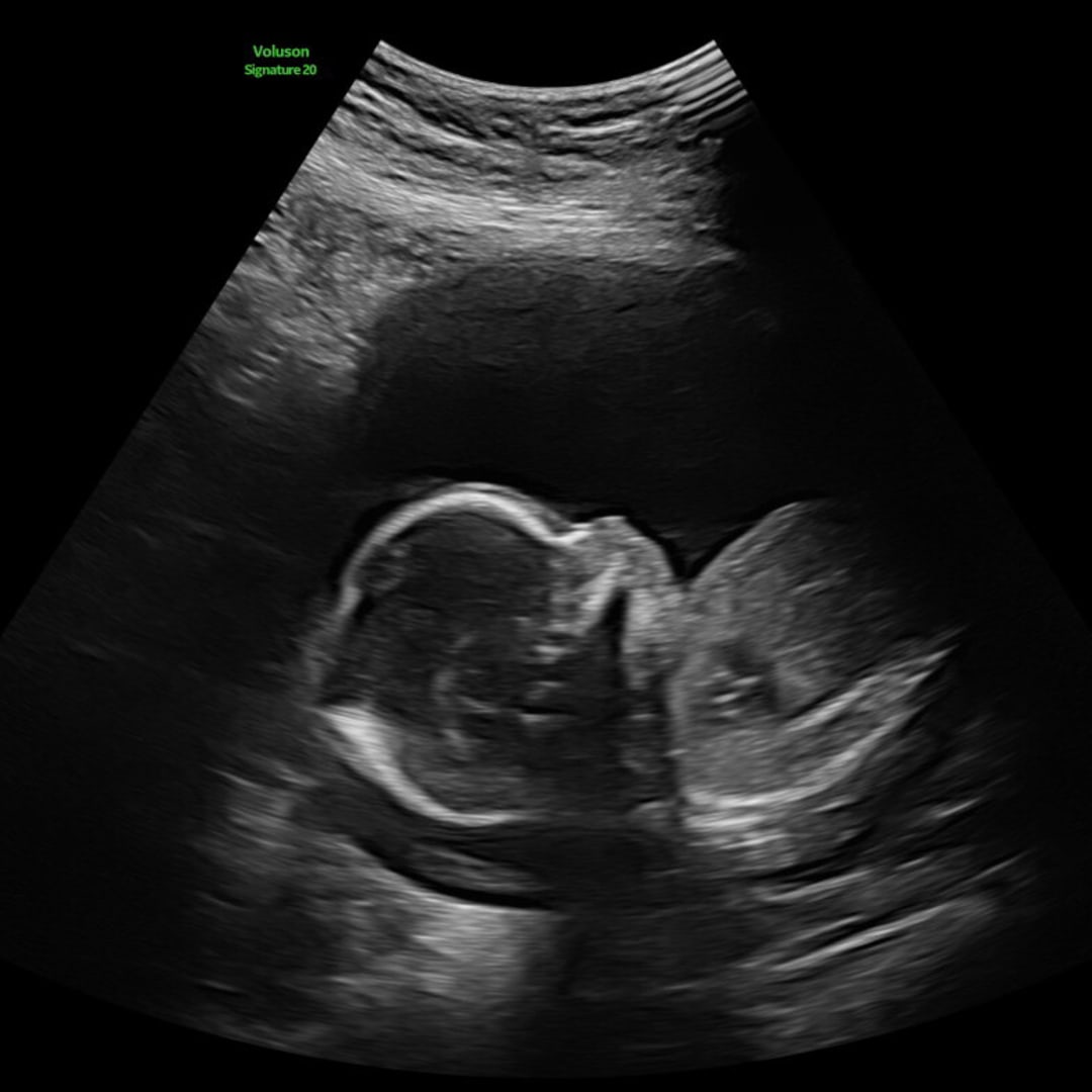Photo shared by Katelin for their Babylist baby registry.