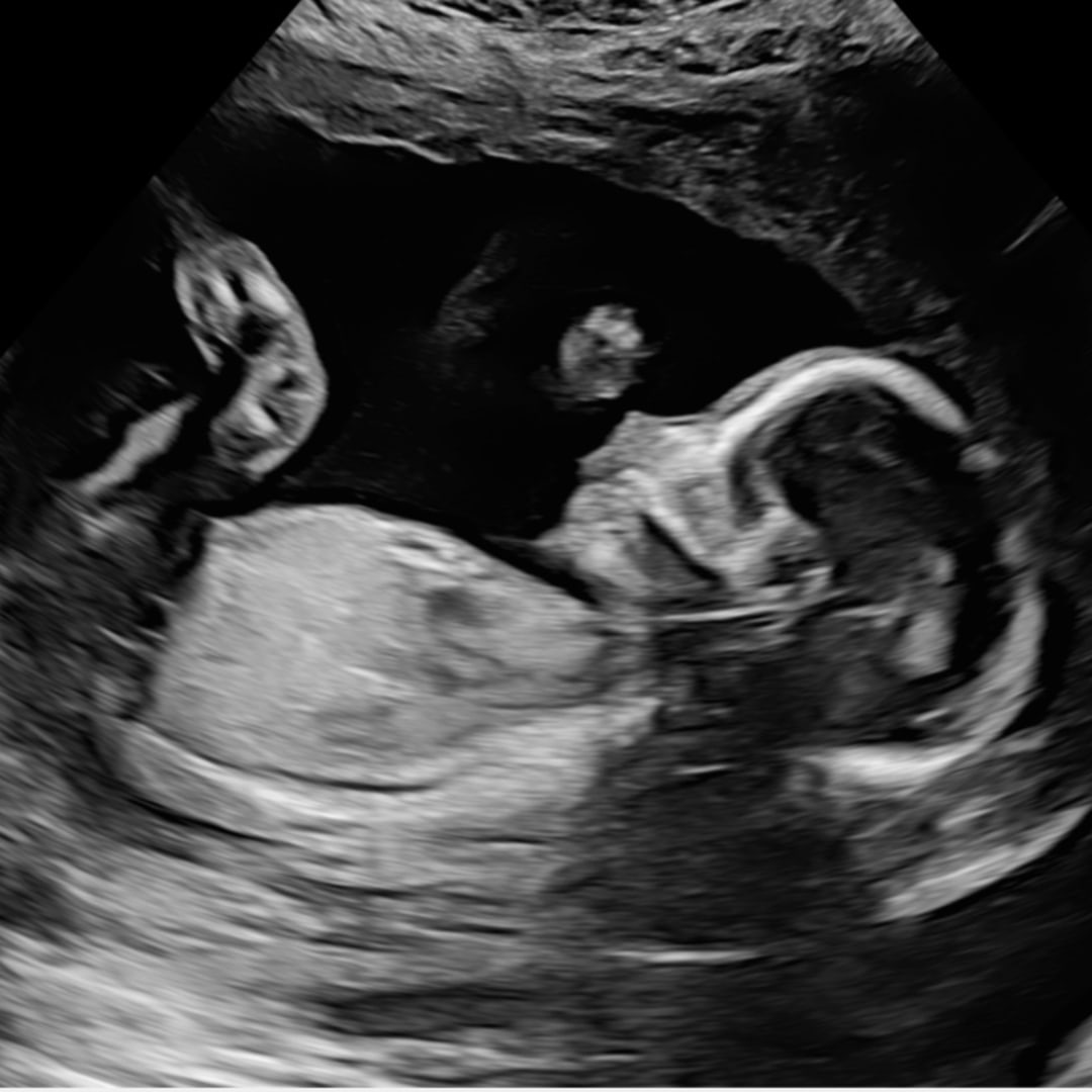 Photo shared by Bethany for their Babylist baby registry.