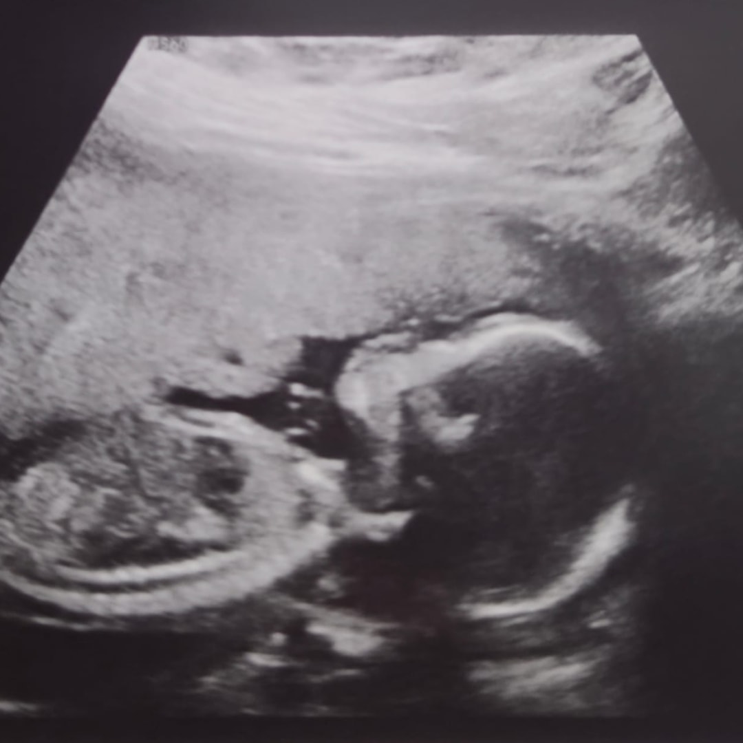 Photo shared by Aryanna for their Babylist baby registry.