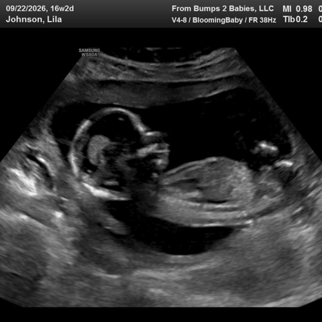 Photo shared by Lila for their Babylist baby registry.