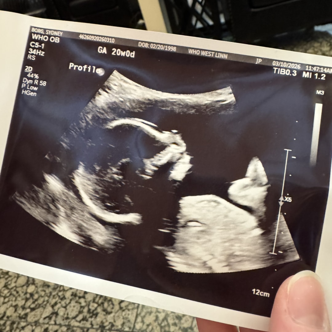 Photo shared by Sydney for their Babylist baby registry.