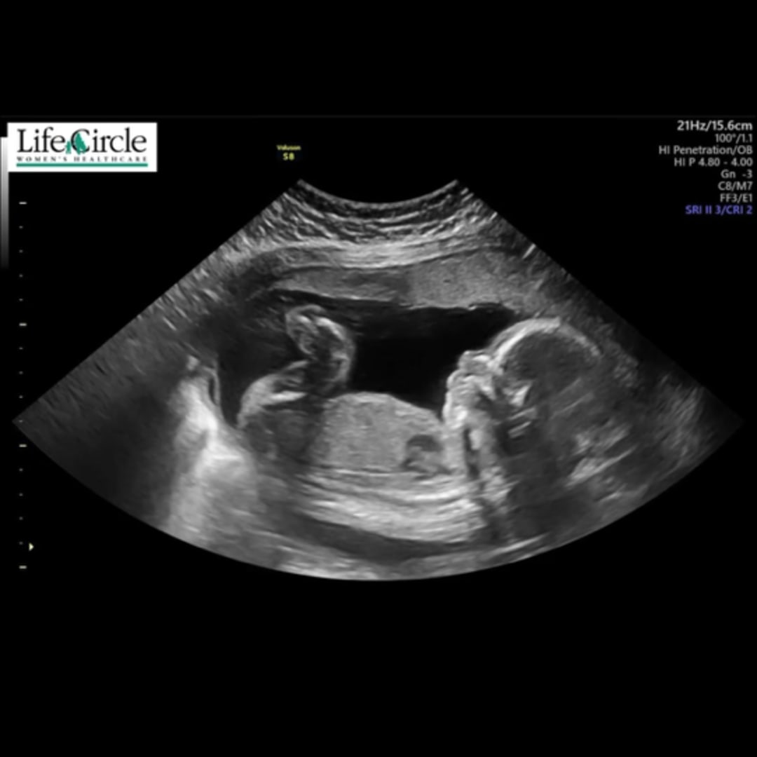 Photo shared by Harley for their Babylist baby registry.
