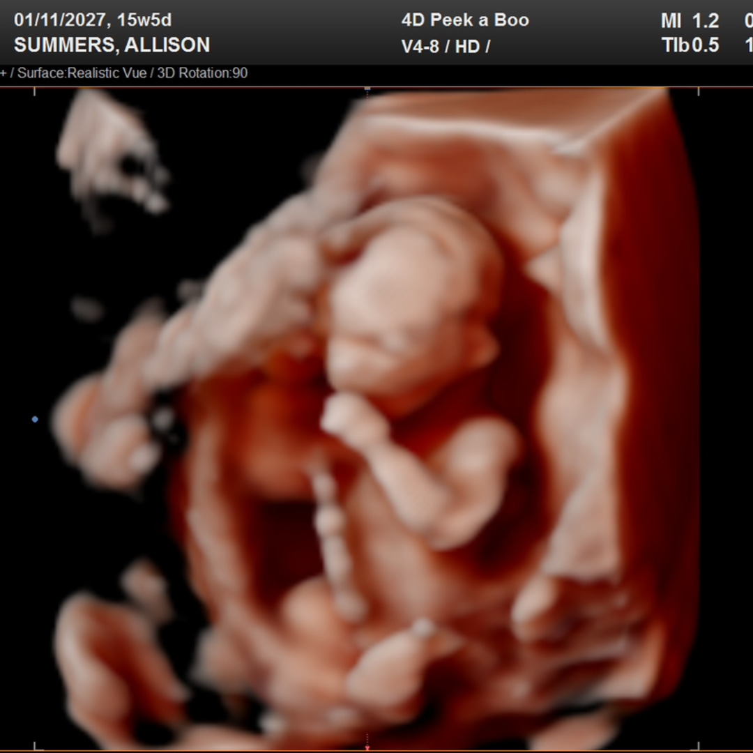 Photo shared by Allison for their Babylist baby registry.