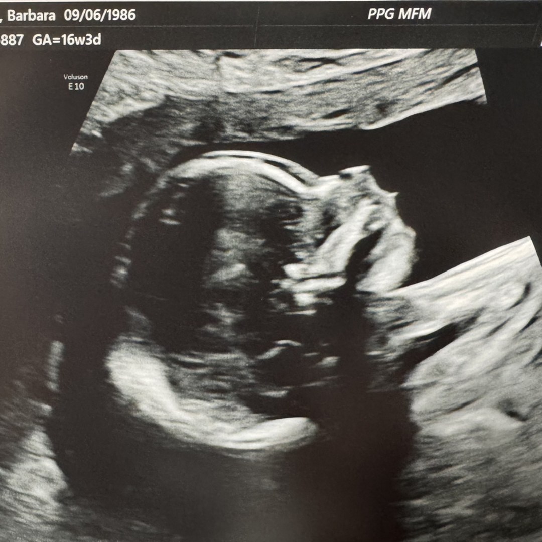 Photo shared by Barbara for their Babylist baby registry.