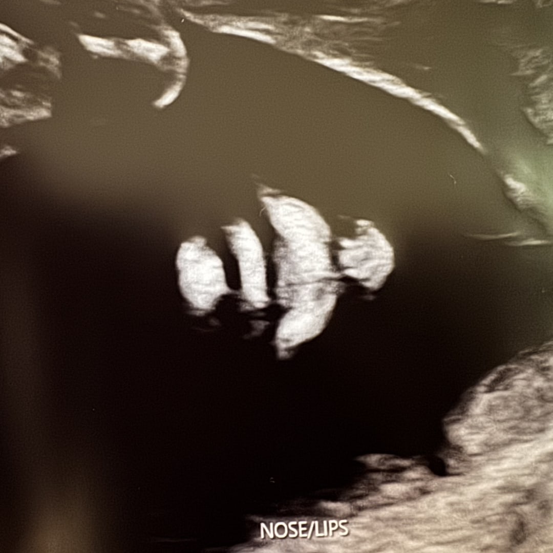 Photo shared by Rachel for their Babylist baby registry.