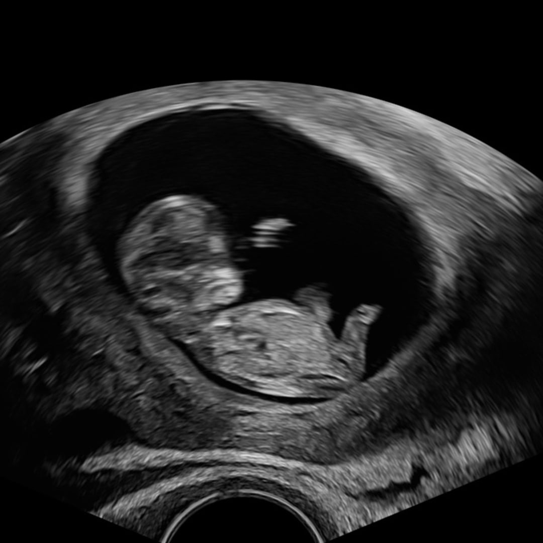 Photo shared by Grace for their Babylist baby registry.