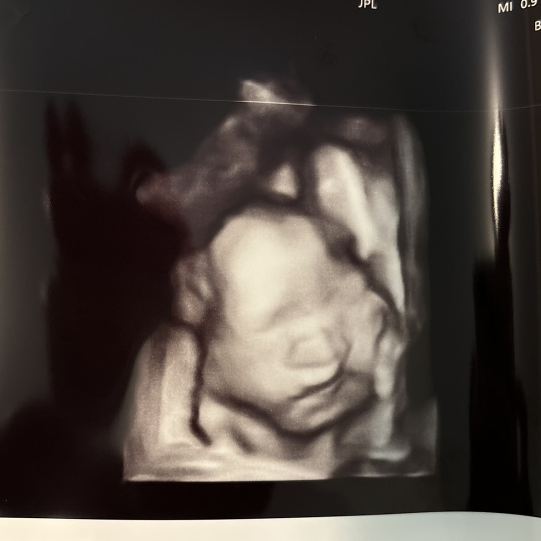 Photo shared by Jolina for their Babylist baby registry.