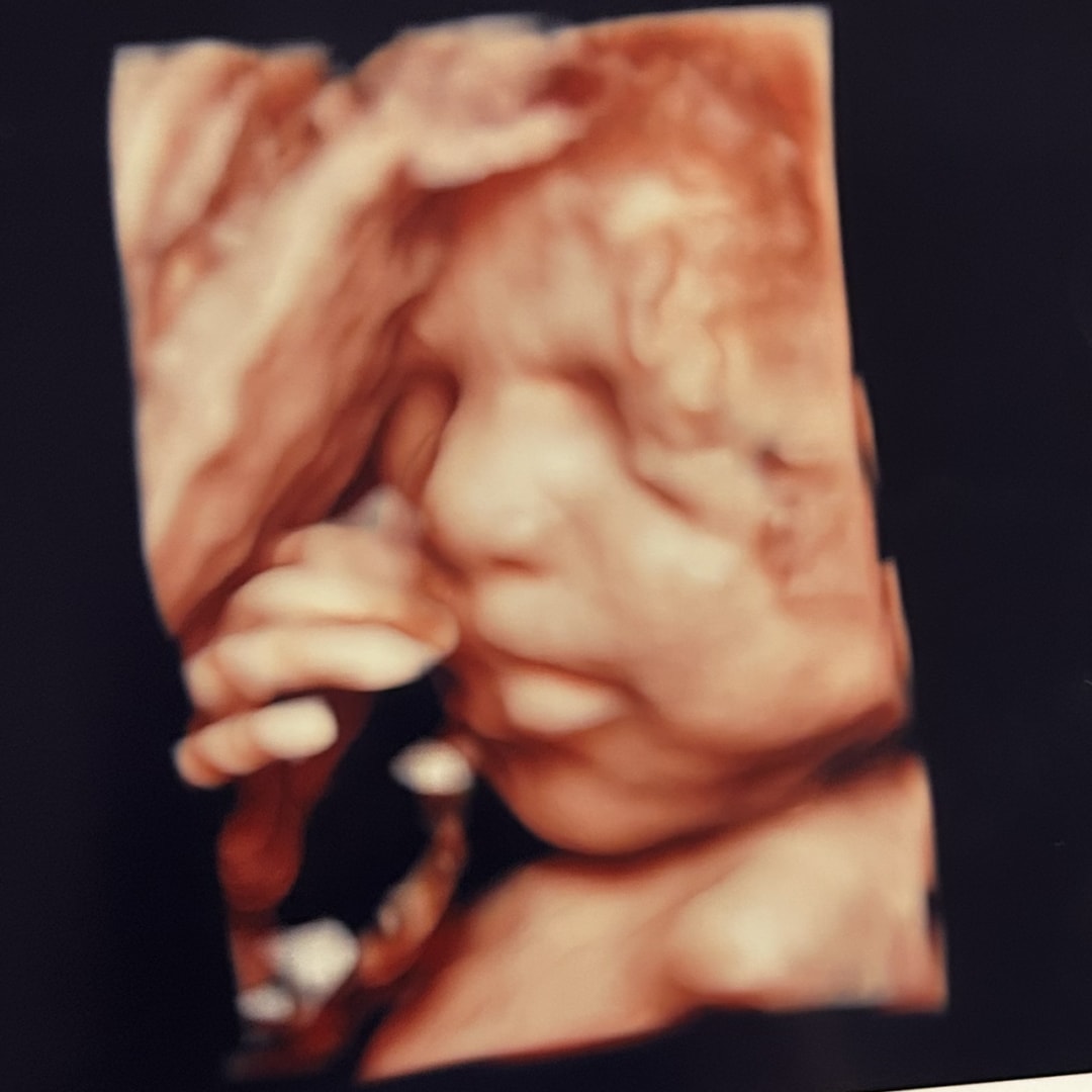 Photo shared by Elvira for their Babylist baby registry.