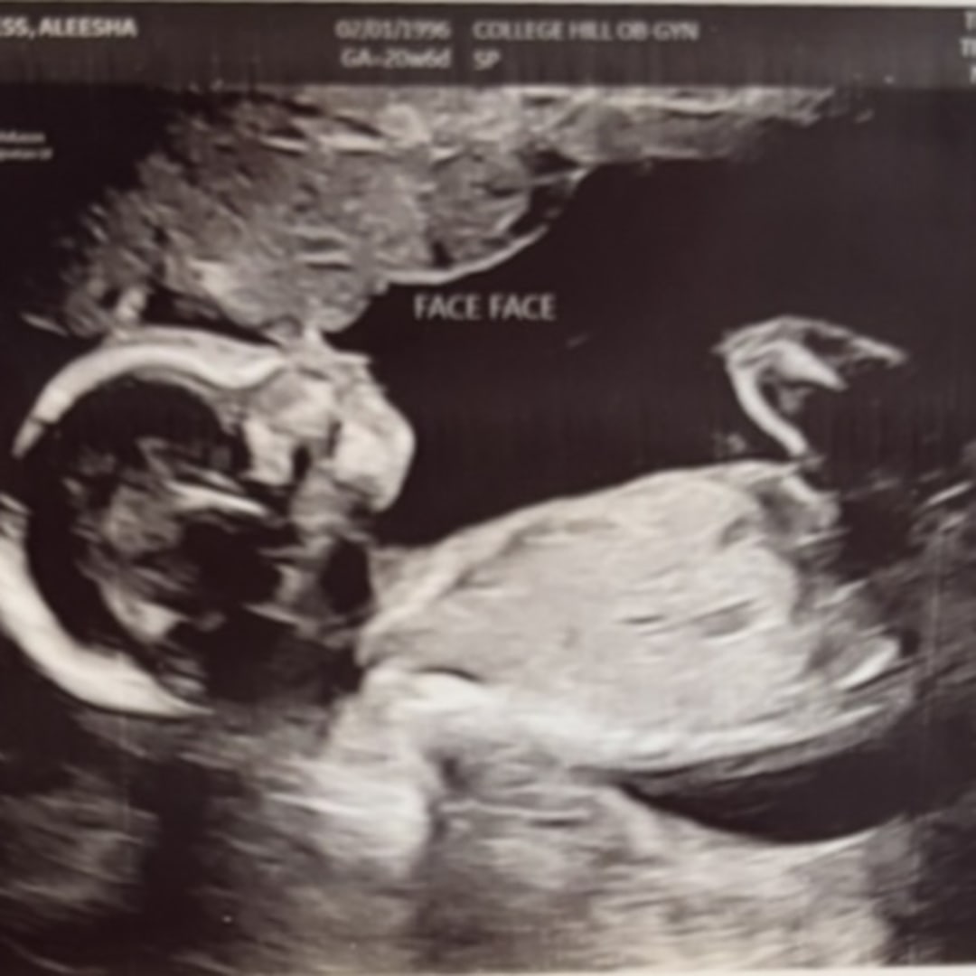 Photo shared by Aleesha for their Babylist baby registry.