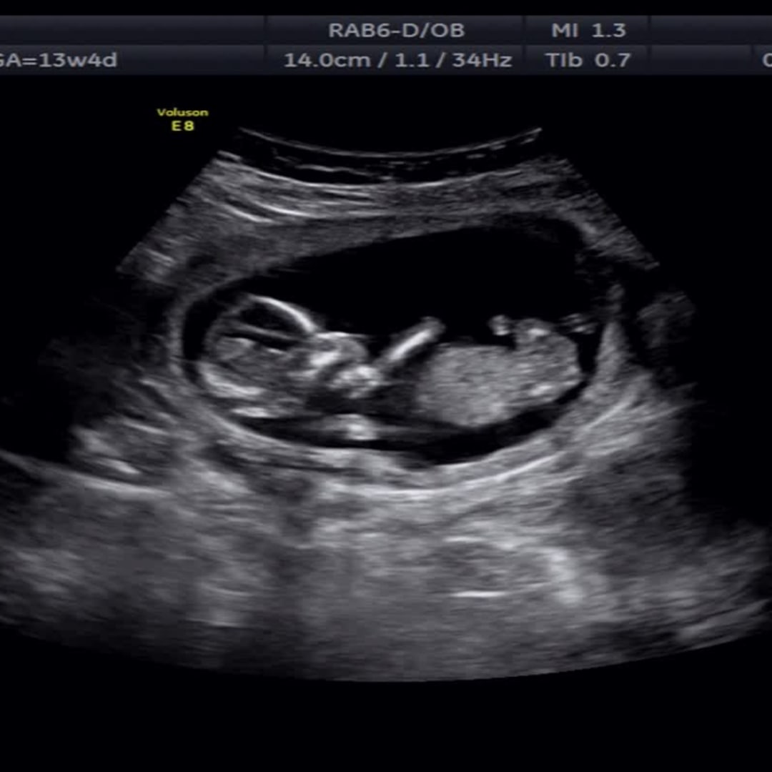 Photo shared by Taylor for their Babylist baby registry.