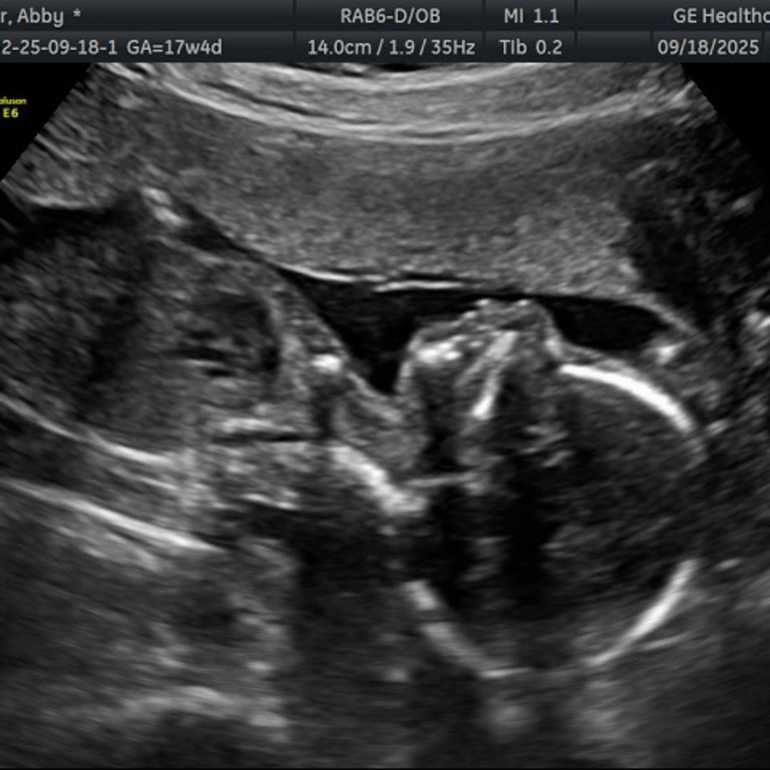 Photo shared by Abby for their Babylist baby registry.