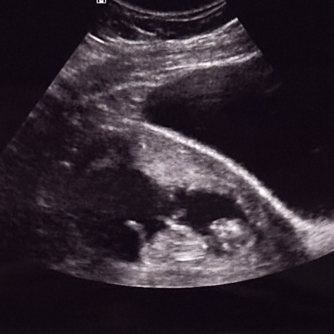 Photo shared by Samantha for their Babylist baby registry.