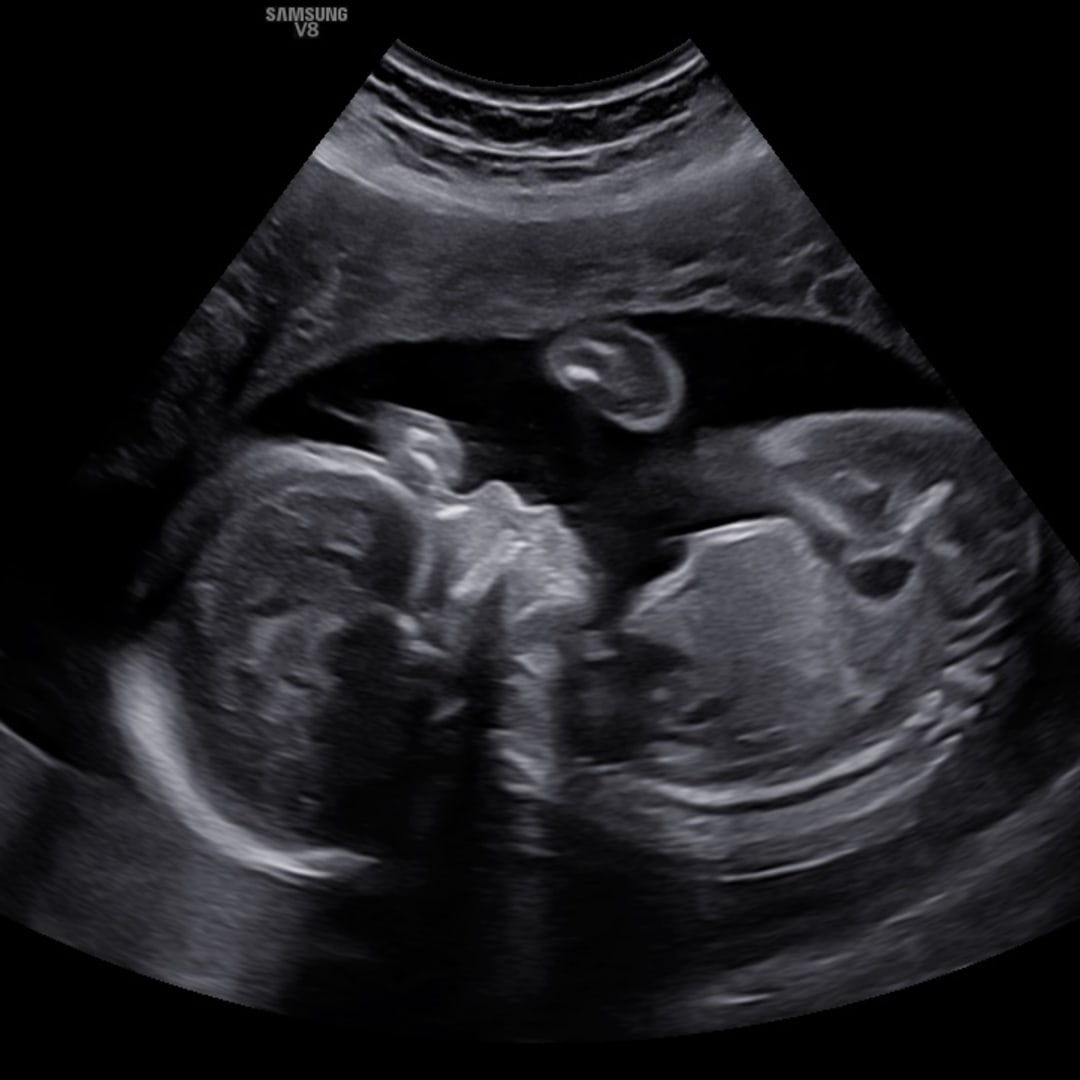 Photo shared by Alisha for their Babylist baby registry.
