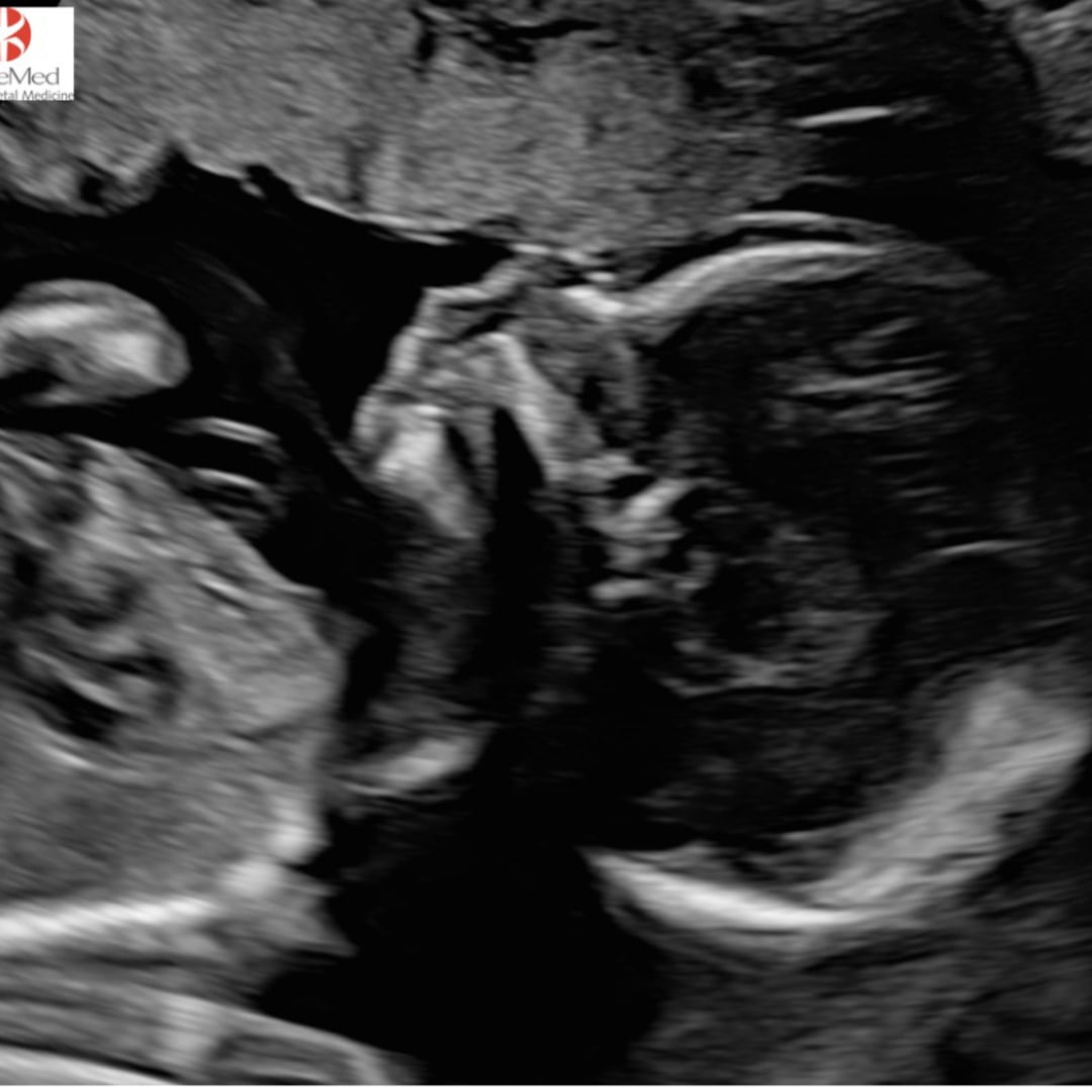 Photo shared by KaDejah for their Babylist baby registry.