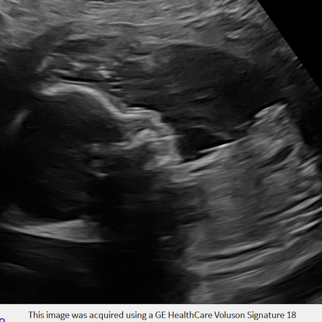 Photo shared by Yessica for their Babylist baby registry.