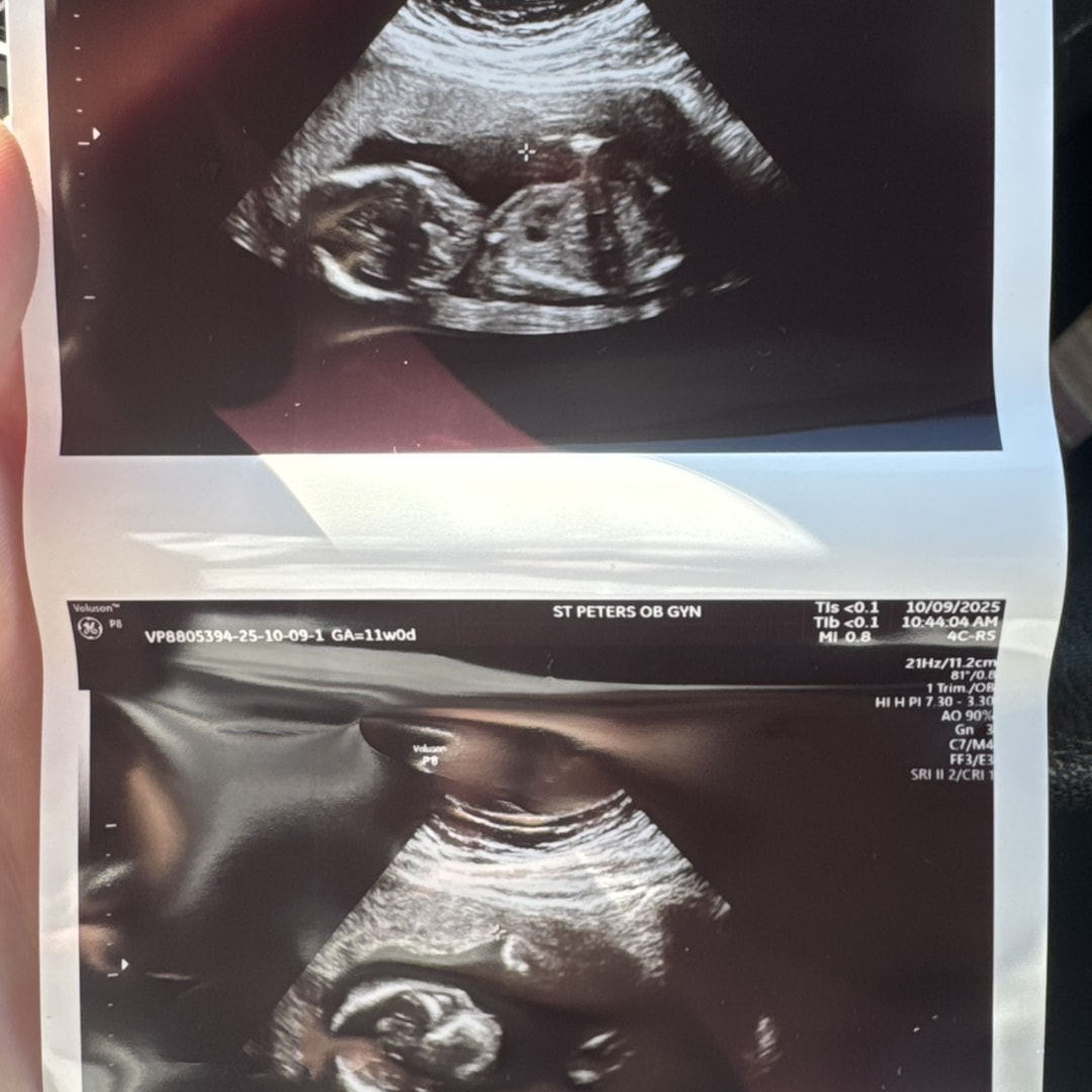 Photo shared by Nadine for their Babylist baby registry.