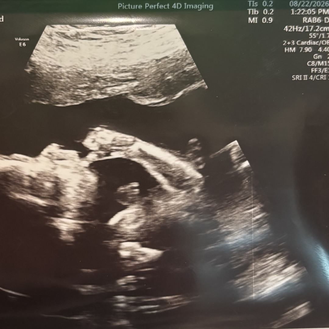 Photo shared by Cinnamon for their Babylist baby registry.