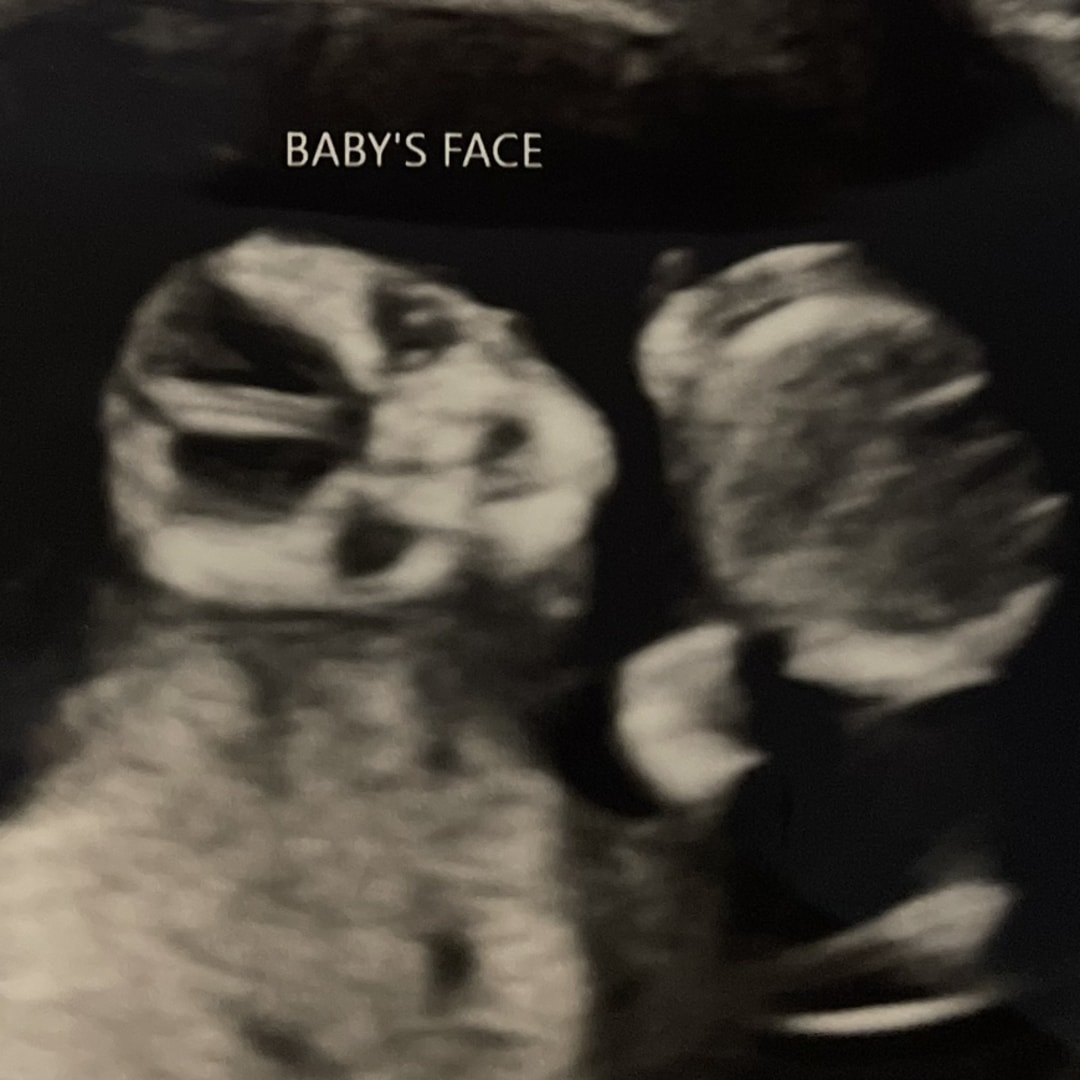 Photo shared by Calaybra for their Babylist baby registry.