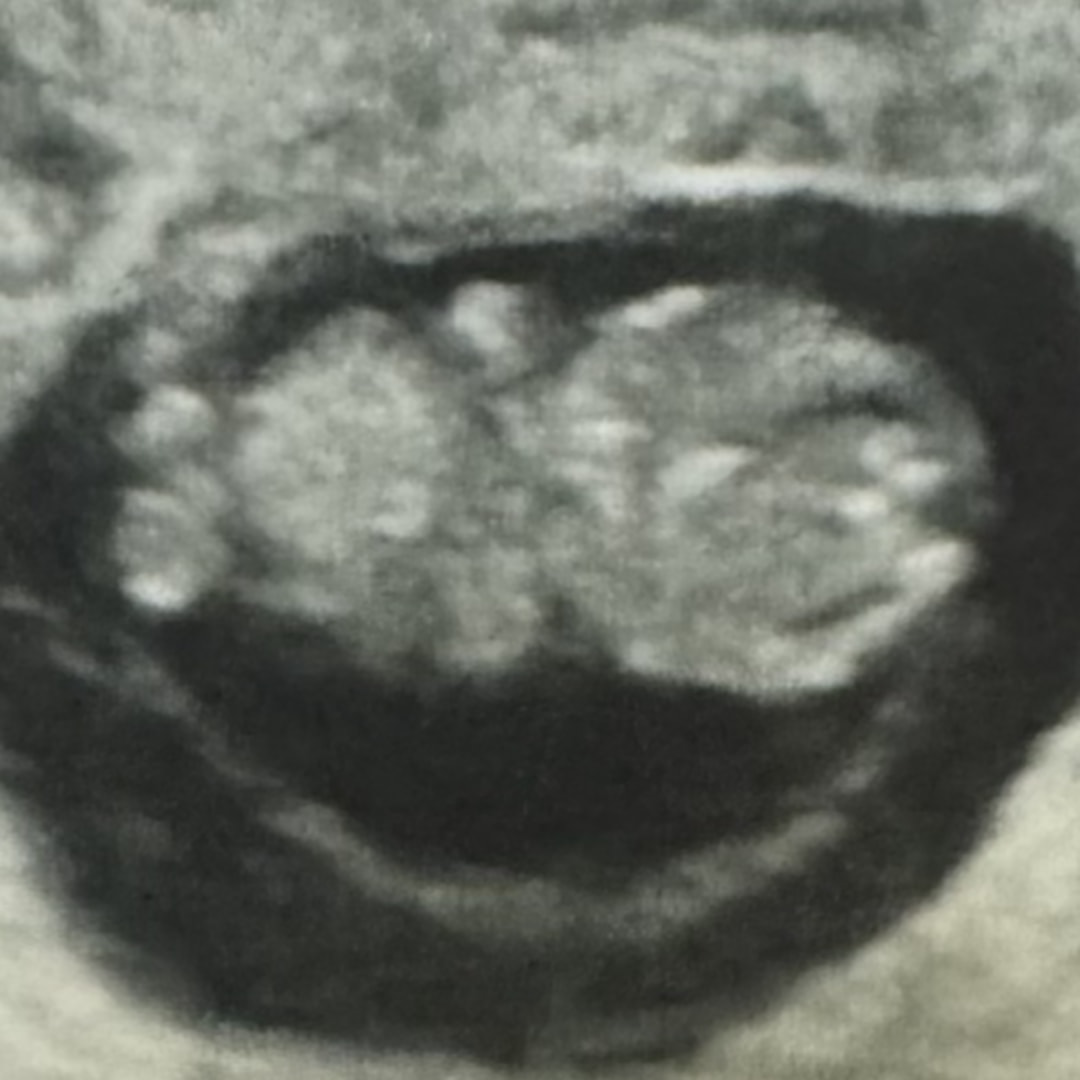 Photo shared by Alexis for their Babylist baby registry.