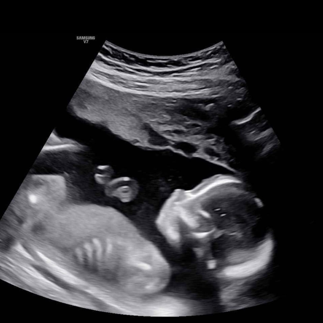 Photo shared by Maria for their Babylist baby registry.