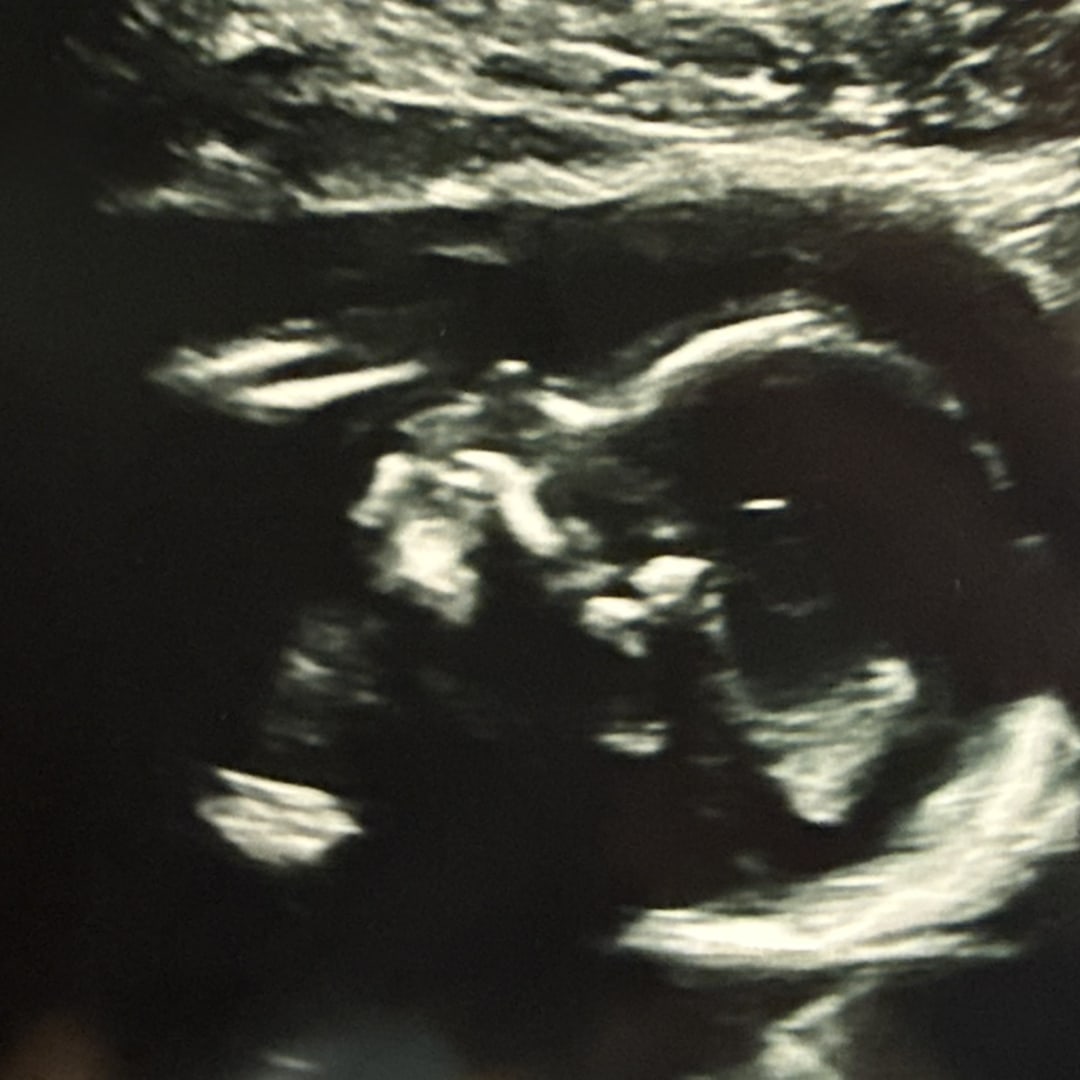 Photo shared by Gabrielle for their Babylist baby registry.