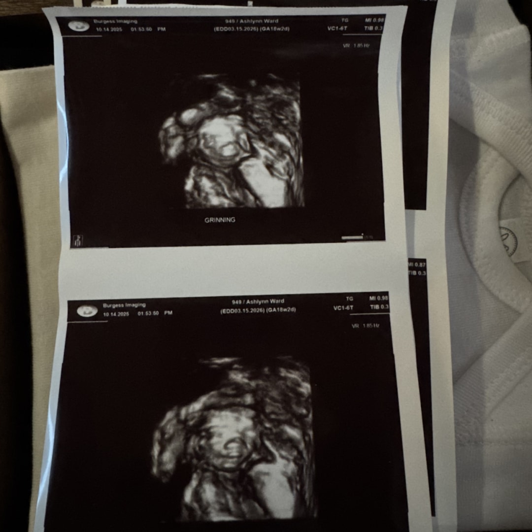 Photo shared by Ashlynn for their Babylist baby registry.