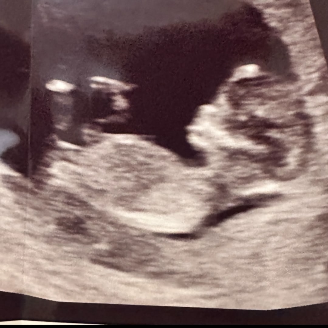 Photo shared by Hannah for their Babylist baby registry.