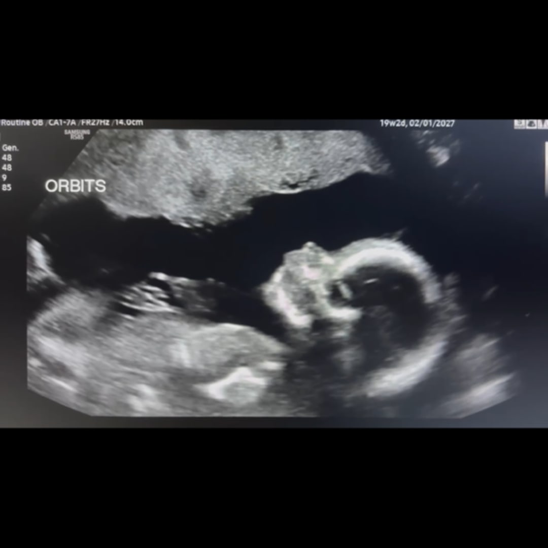 Photo shared by Lee for their Babylist baby registry.