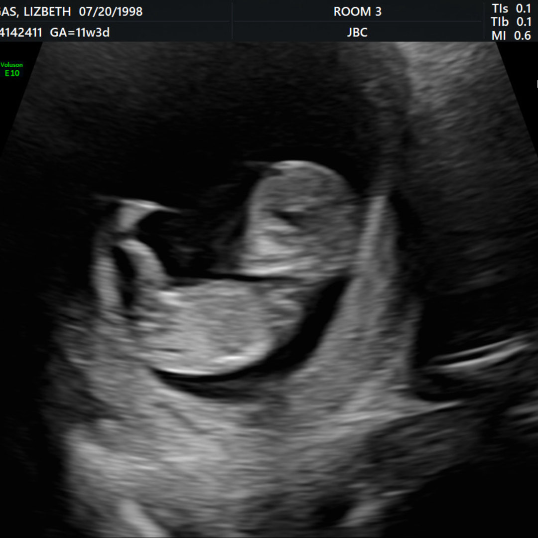 Photo shared by Lizbeth for their Babylist baby registry.