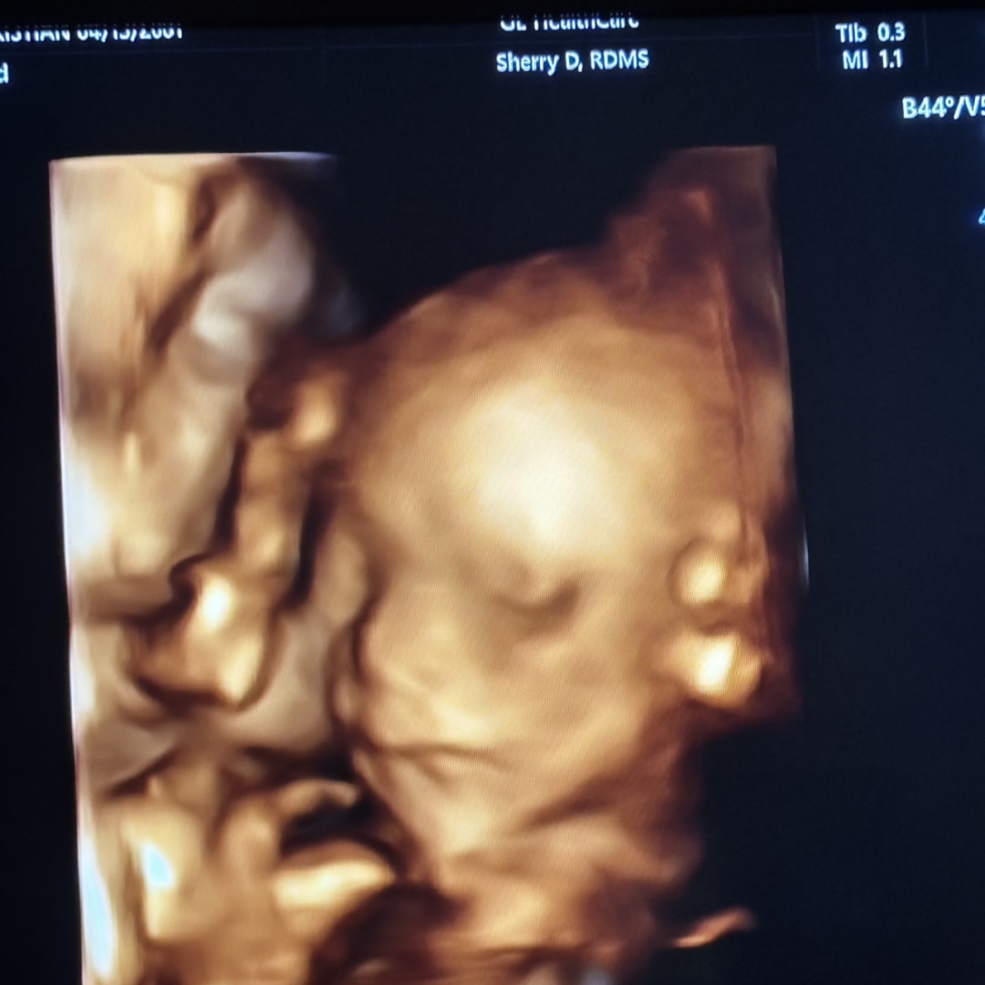 Photo shared by Charity for their Babylist baby registry.