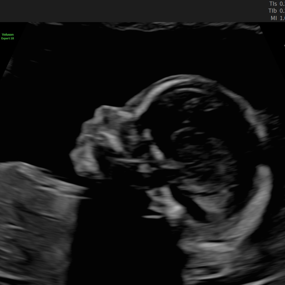 Photo shared by Alex for their Babylist baby registry.