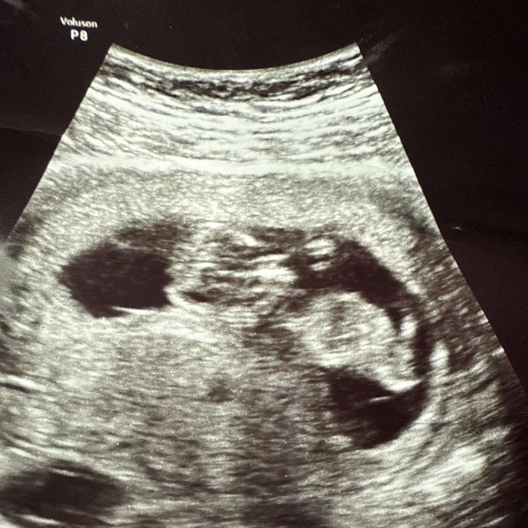 Photo shared by Jessica for their Babylist baby registry.