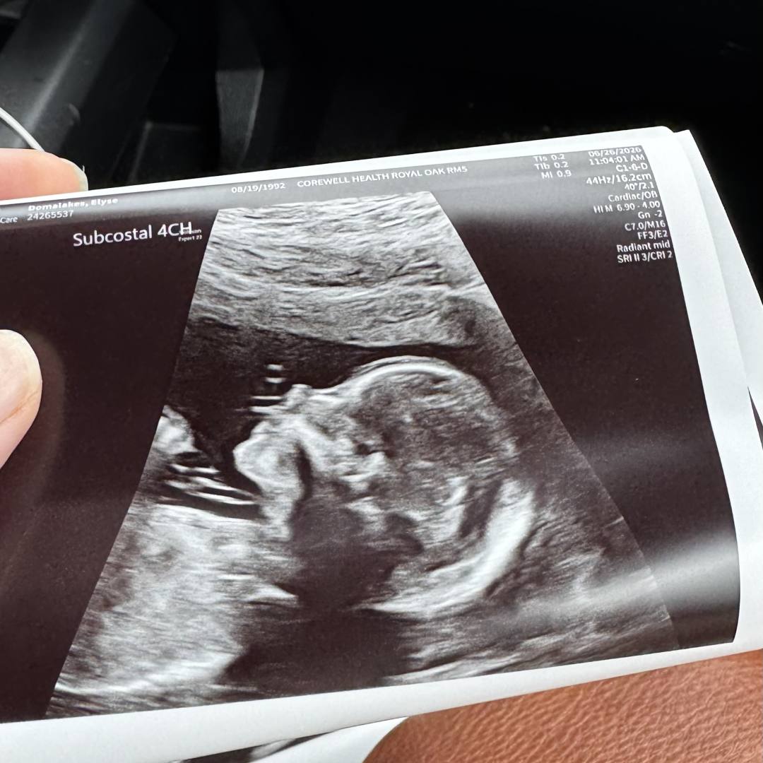 Photo shared by Elyse for their Babylist baby registry.