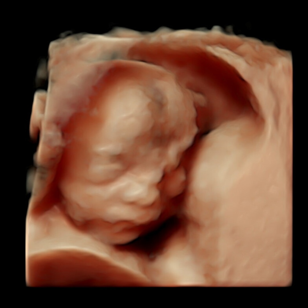 Photo shared by Meg for their Babylist baby registry.