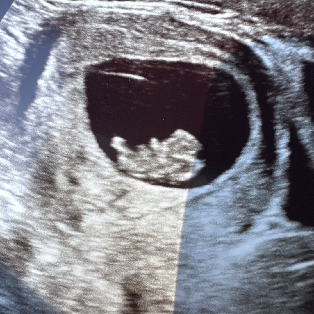 Photo shared by Desiree for their Babylist baby registry.