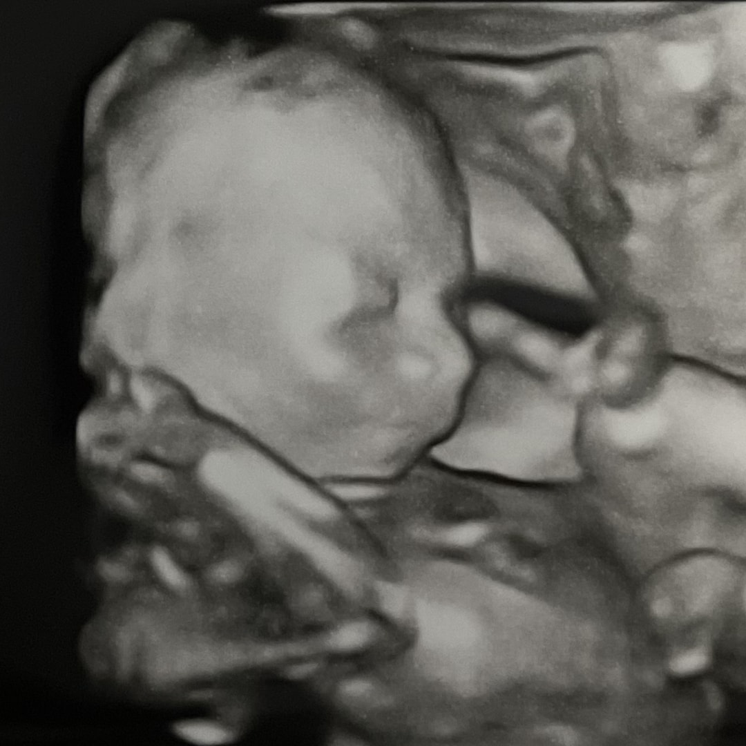 Photo shared by Mary Beth for their Babylist baby registry.