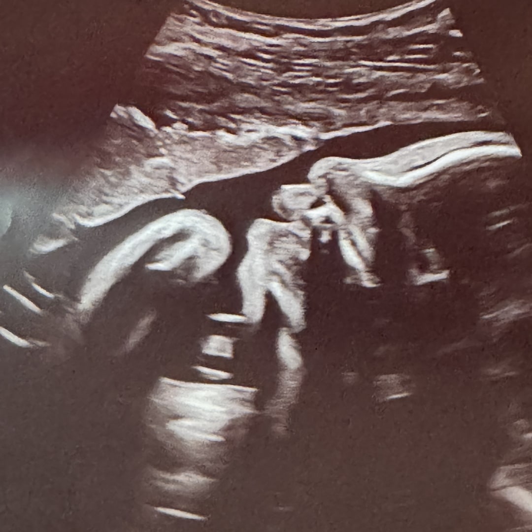Photo shared by Dekenya for their Babylist baby registry.