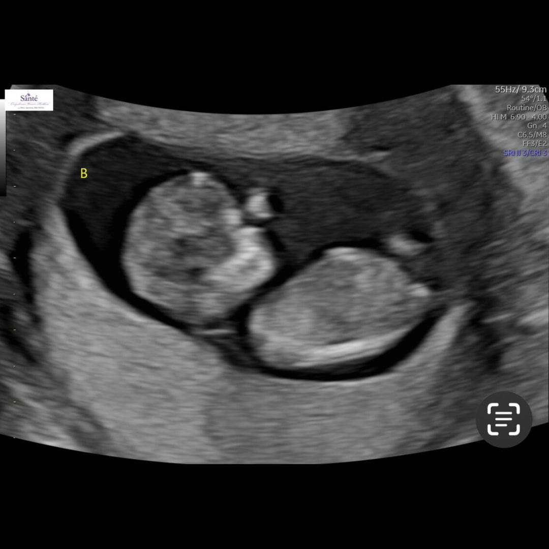 Photo shared by Jacklyn for their Babylist baby registry.