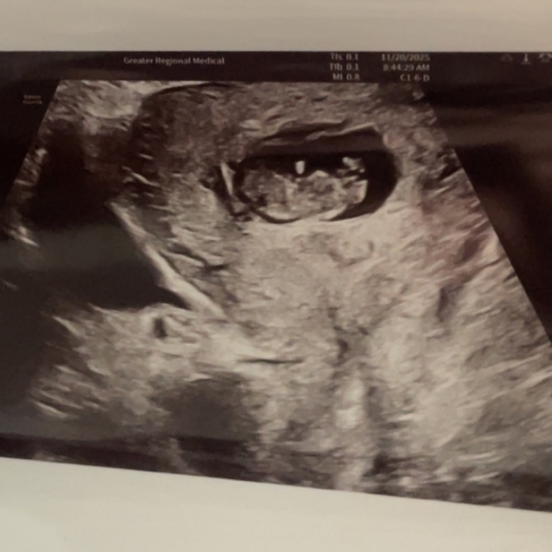 Photo shared by Behle for their Babylist baby registry.