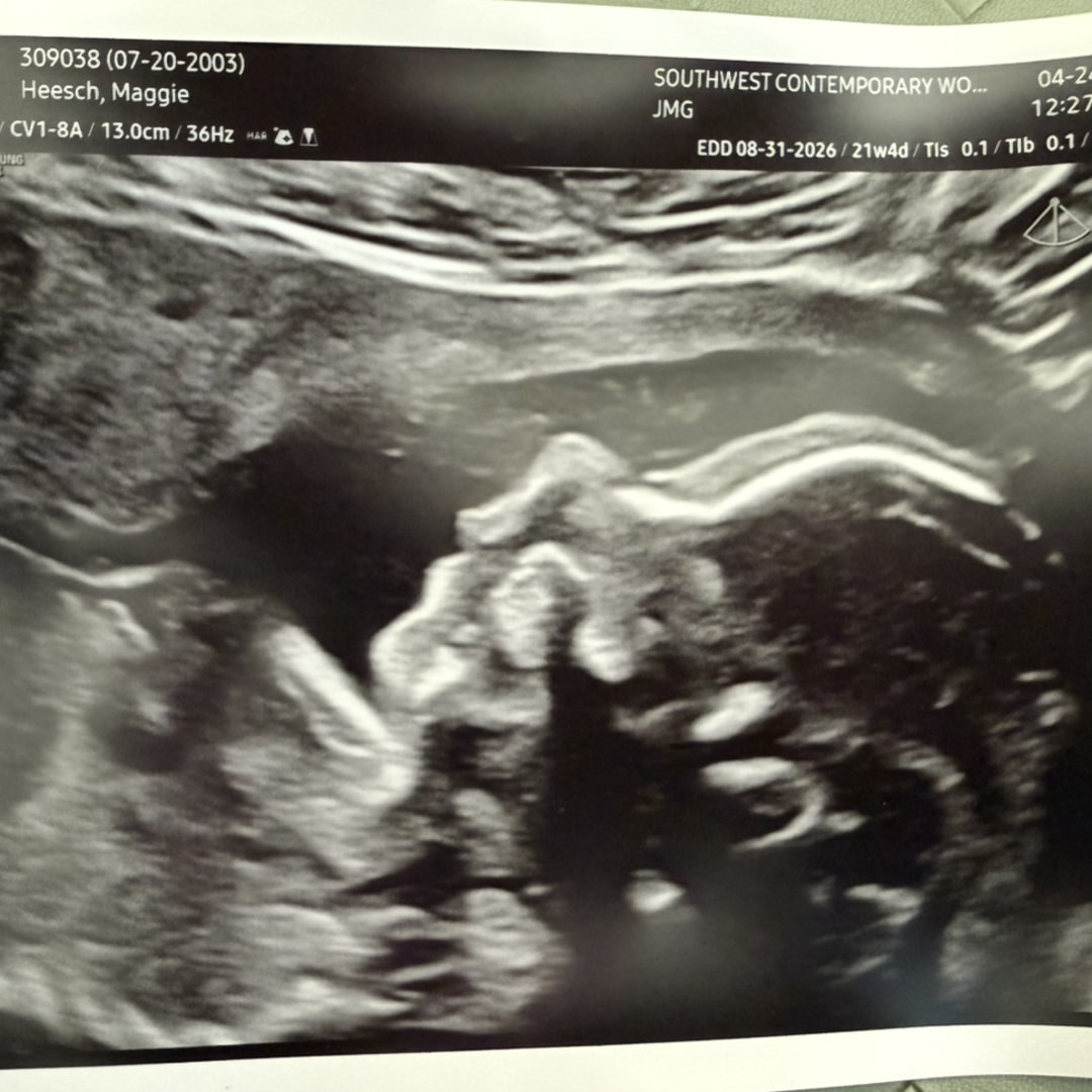 Photo shared by Maggie for their Babylist baby registry.