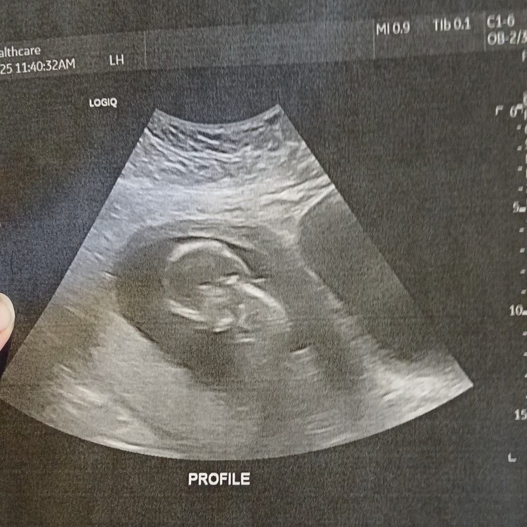 Photo shared by Patience for their Babylist baby registry.