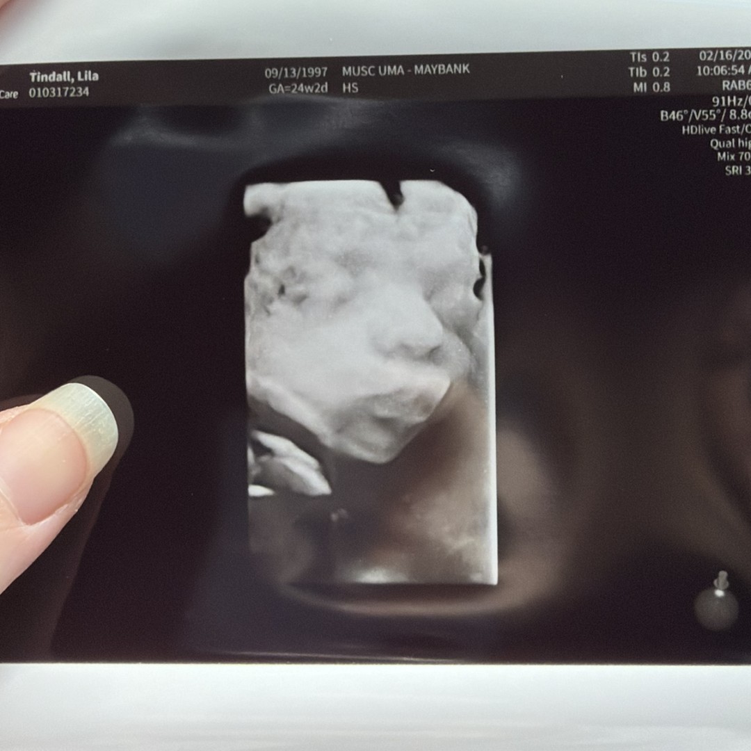 Photo shared by Lila for their Babylist baby registry.