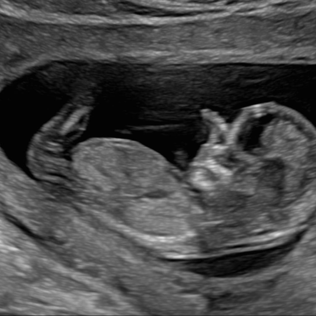 Photo shared by Heather for their Babylist baby registry.