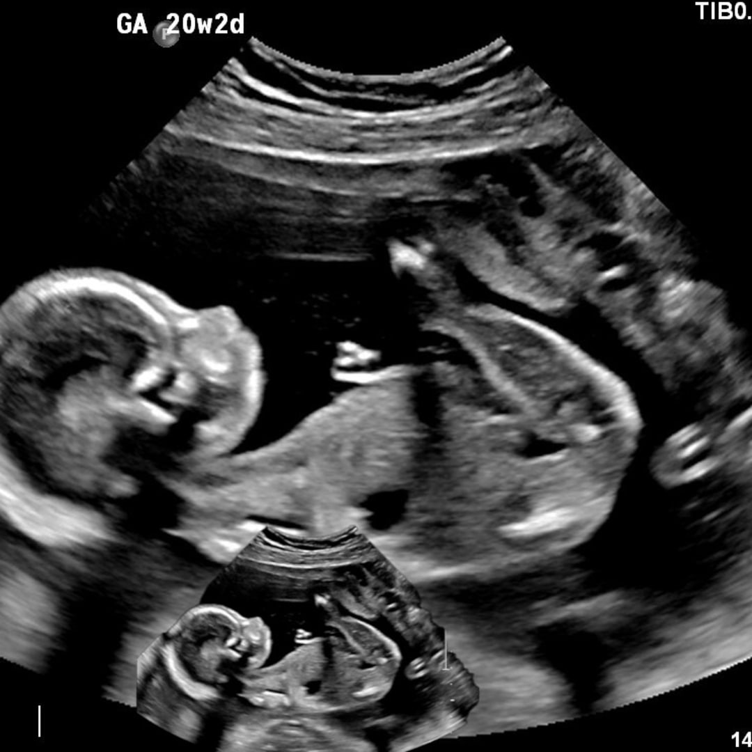 Photo shared by Sarah for their Babylist baby registry.