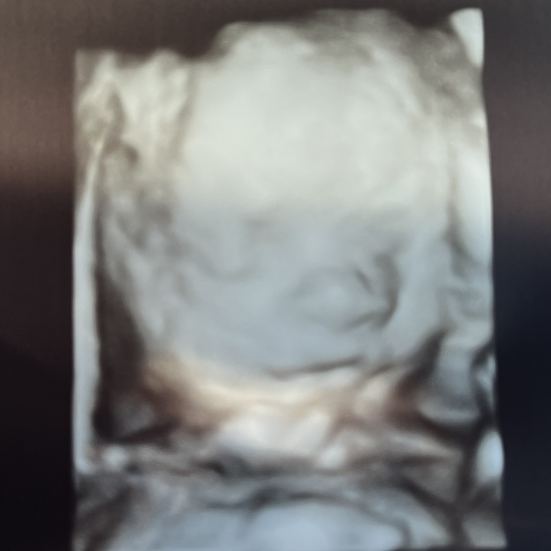 Photo shared by Annie for their Babylist baby registry.